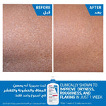 CeraVe Intensive Moisturising Lotion 236ml for Very Dry Skin with Ceramides and Hyaluronic Acid
