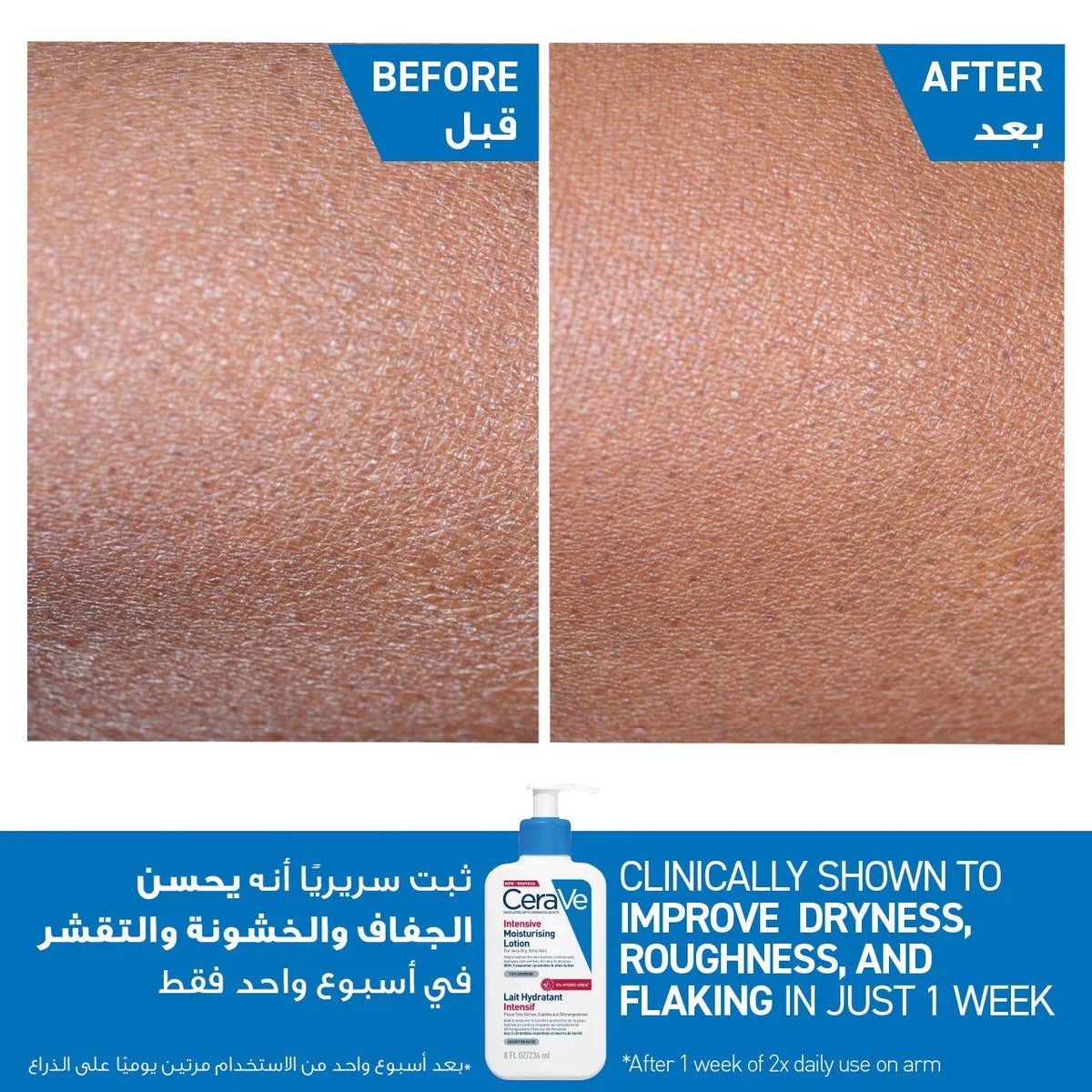 CeraVe Intensive Moisturising Lotion 236ml for Very Dry Skin with Ceramides and Hyaluronic Acid
