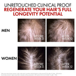 Vichy Dercos Aminexil Clinical R.E.G.E.N. Booster Hair Renewing Serum 90ml for Hair Loss