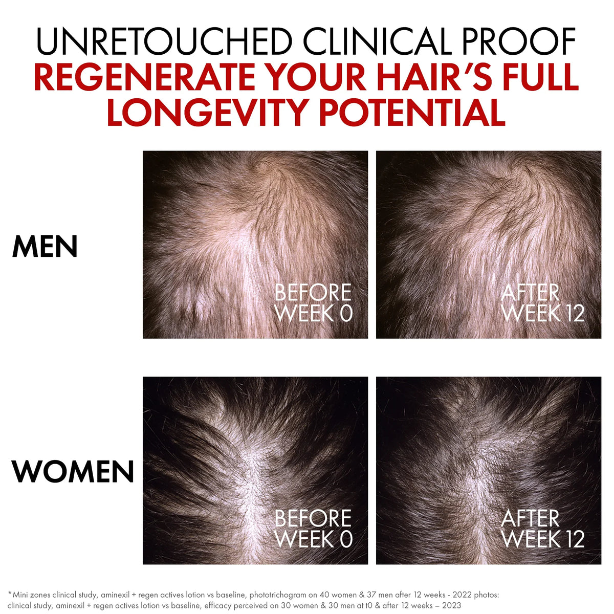 Vichy Dercos Aminexil Clinical R.E.G.E.N. Booster Hair Renewing Serum 90ml for Hair Loss