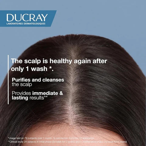 Ducray Kelual Squanorm Moisturizing Treatment Shampoo - Dry Dandruff