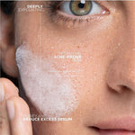 La Roche-Posay Effaclar Micro-Peeling Purifying Gel | Purifying Facial Cleanser for Oily and Acne-Prone Skin